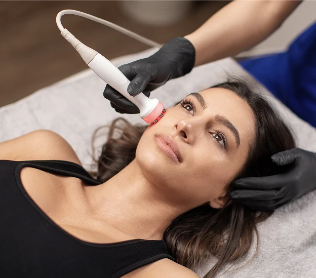 A women wearing a black tank top lays on a exam table. She has brown hair and eyes. There is a Renuvion tool on her cheek. There is a person with black gloves and a blue smock, holding the device. - Renuvion in Santa Barbara, CA