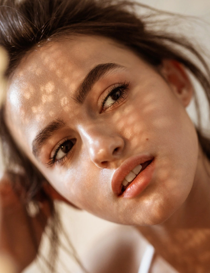 a close up of a women's face. Her head is tilted towards the left side of the image and she has her mouth slightly open. She has dark brown hair put up into a ponytail. - Acne Scar in Santa Barbara, CA