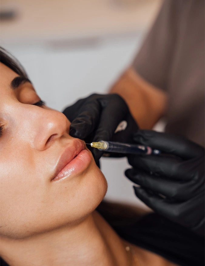Dr. Moradzadeh about to inject into the patient. The doctor is wearing a brown smock. The patient lays in the examination chair. She has dark brown hair with light highlights, - Lip Fillers in Santa Barbara, CA.